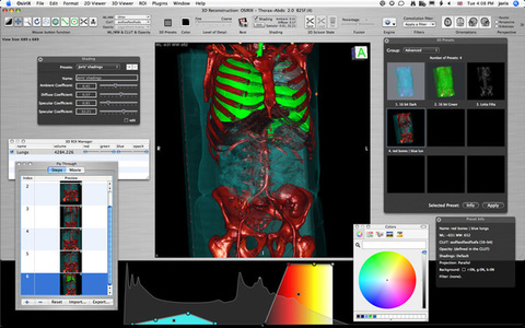 draw freehand roi in osirix lite